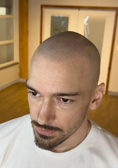 After