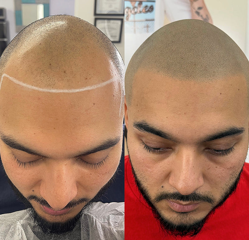 Personalized Treatment Plans